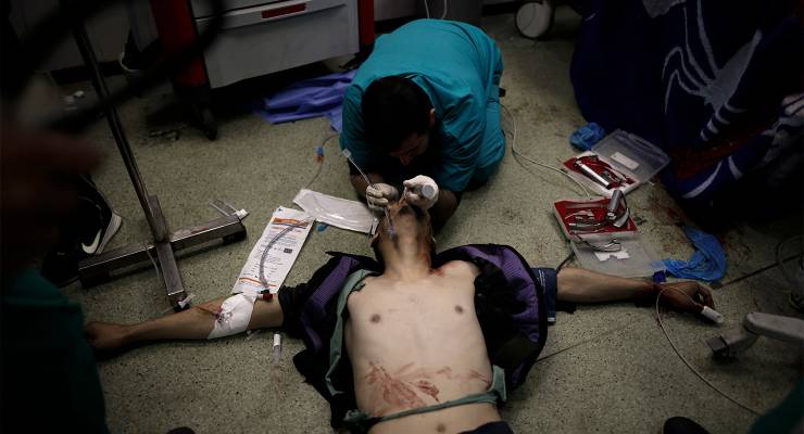A wounded Palestinian receiving treatment on January 22 in Nasser hospital in Gaza's Khan Younis, now in 'catastrophic condition' following an Israeli raid on Friday, February 16 (Image: AAP/Mohammed Dahman)